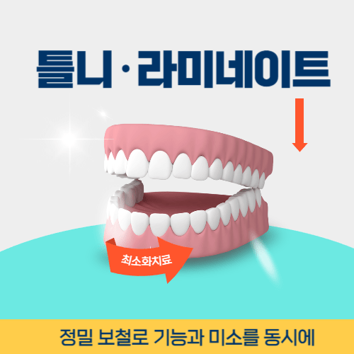 인천치과 인천광역시 치과 틀니 라미네이트
