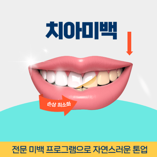 인천치과 인천광역시 치과 치아미백