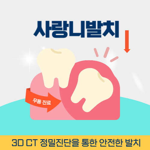 인천치과 인천광역시 치과 사랑니 발치
