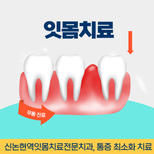 인천치과 인천광역시 치과 잇몸치료
